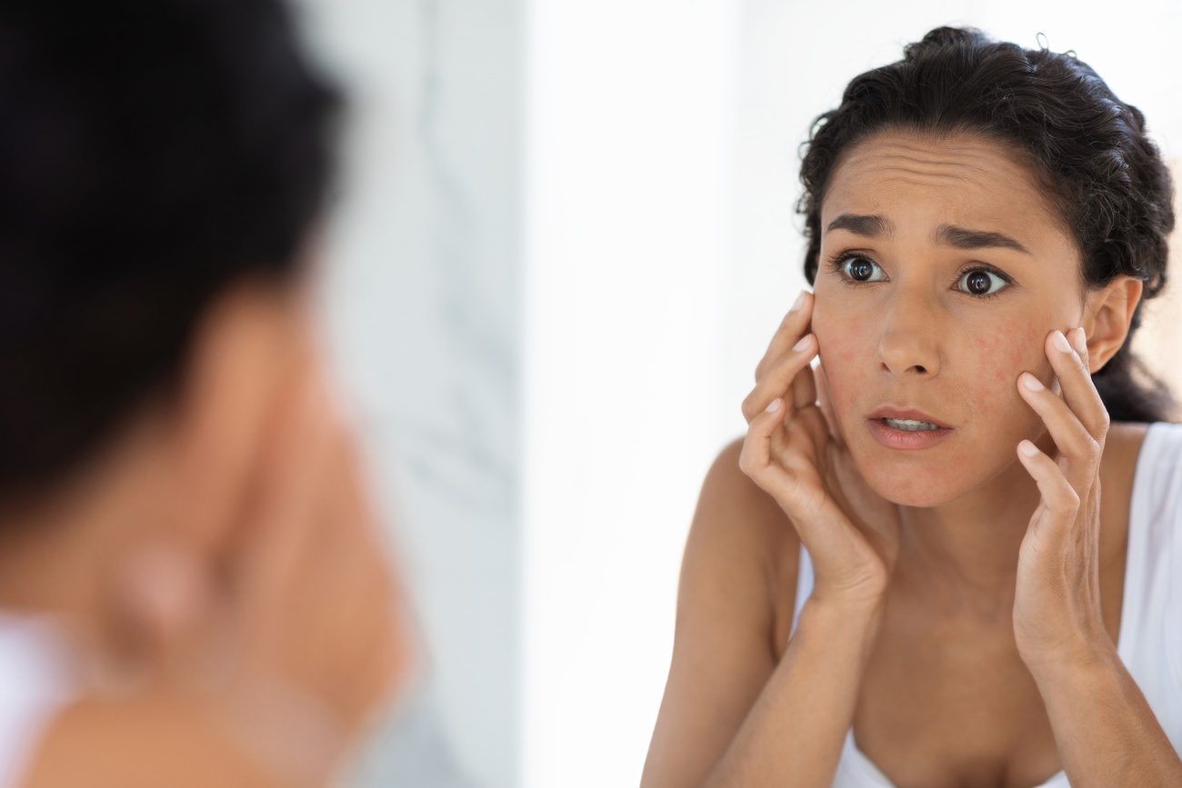 Cold weather can affect your skin Cold weather can affect your skin