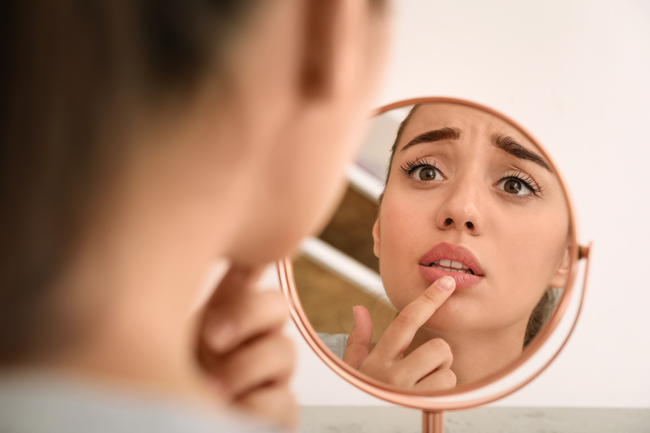 Es importante identificar nuestros labios cuando no están sanos