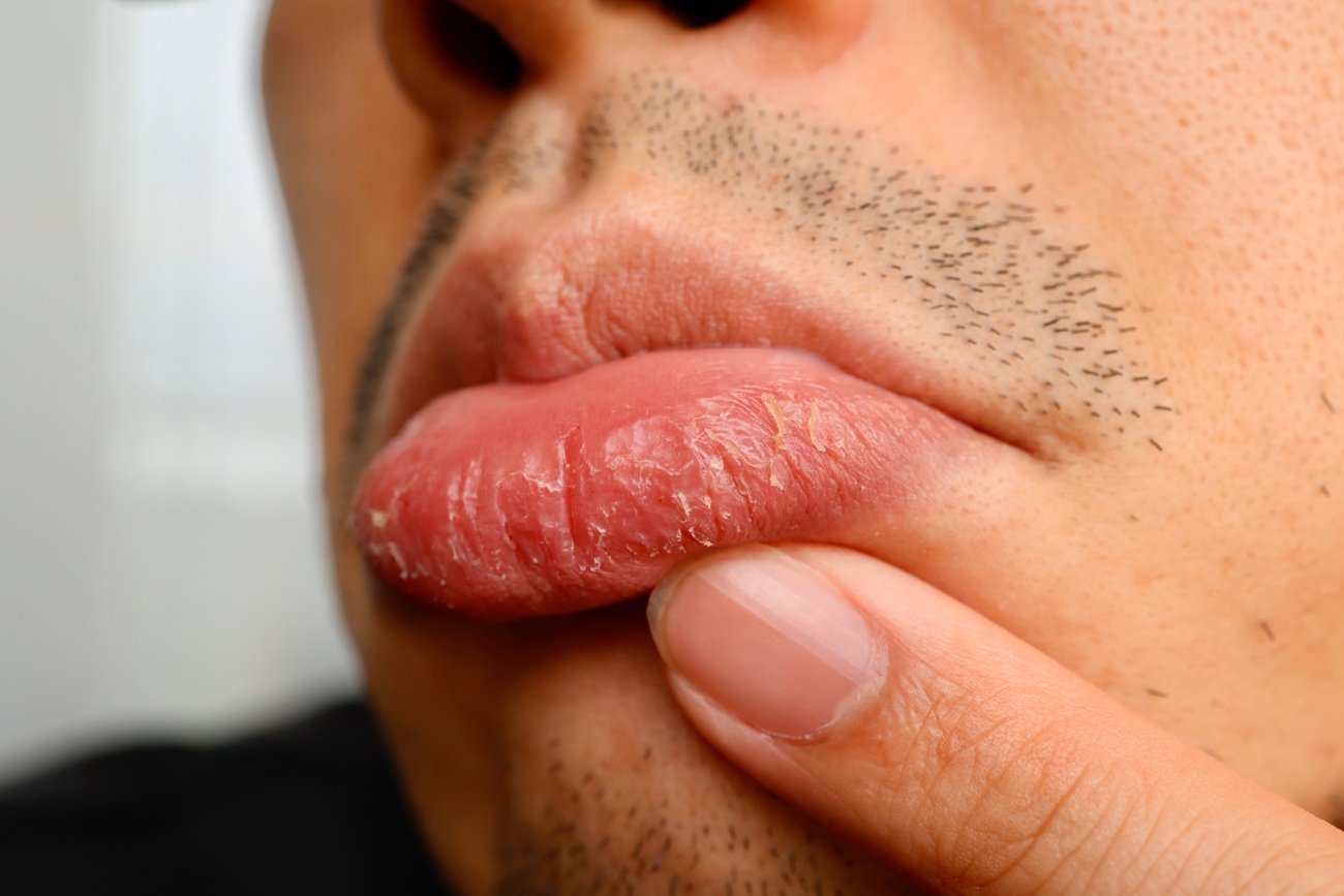 ÇQué lleva a nuestros labios a este punto? ÇQué lleva a nuestros labios a este punto?