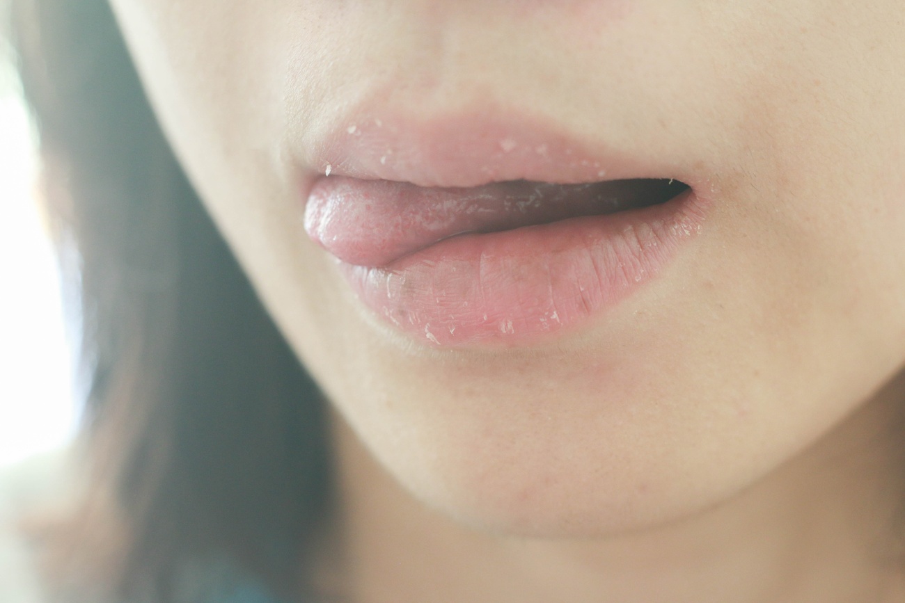 Lamerse mucho los labios Lamerse mucho los labios
